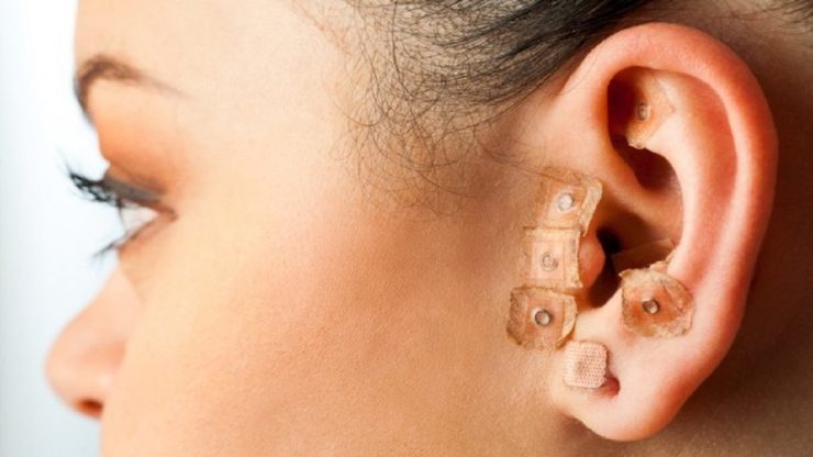il corso di cromoterapia e auricoloterapia permette di conoscere gli effetti del colore sulla nostra salute e la stimolazione dei punti auricolari